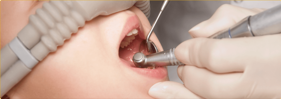 закись азота для детей в стоматологии