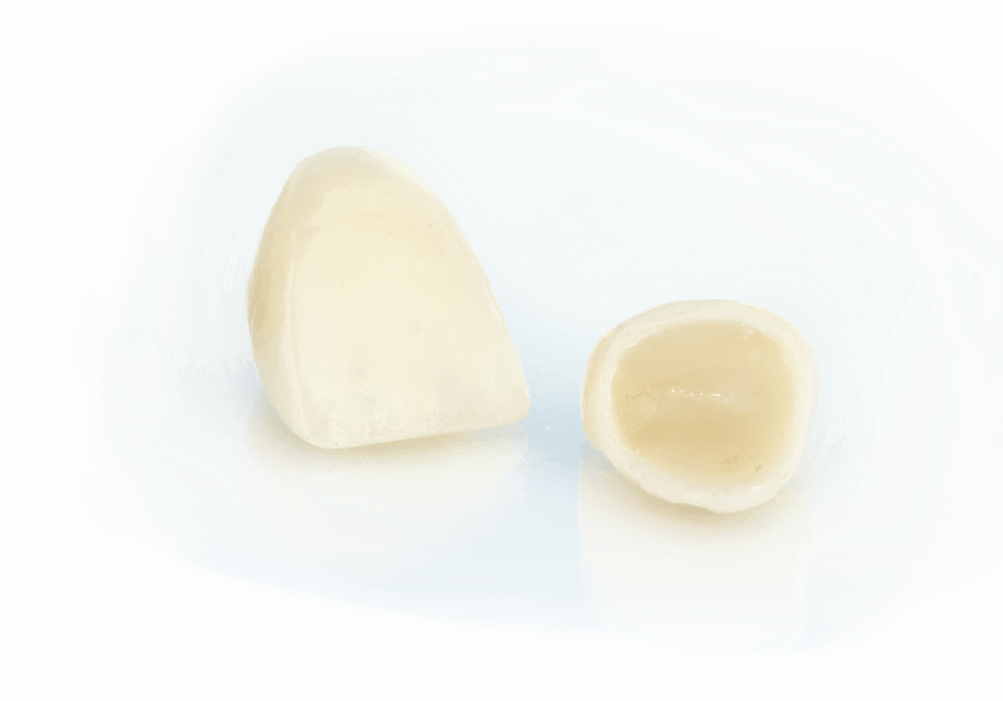 керамическая коронка фото